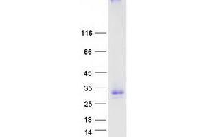 Validation with Western Blot