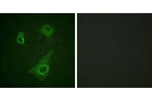 P-peptide - +Western blot analysis of extracts from K562 cells, using Epo-R (Phospho-Tyr368) antibody.