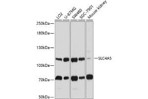 Western blot analysis of extracts of various cell lines, using SLC4 antibody (ABIN6132890, ABIN6148015, ABIN6148016 and ABIN6214688) at 1:1000 dilution. (NBC4 anticorps  (AA 1042-1121))