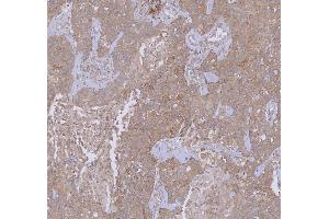 IHC analysis of WDR44 using anti-WDR44 antibody (ABIN7600394). (WDR44 anticorps  (AA 188-913))