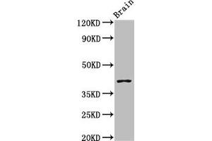 Western Blot Positive WB detected in: Mouse brain tissue All lanes: SEPT3 antibody at 3 μg/mL Secondary Goat polyclonal to rabbit IgG at 1/50000 dilution Predicted band size: 41, 10 kDa Observed band size: 41 kDa (Septin 3 anticorps  (AA 238-358))