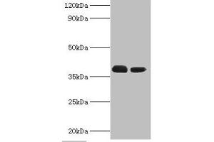 Western blot All lanes: Three-prime repair exonuclease 1 antibody at 3 μg/mL Lane 1: Hela whole cell lysate Lane 2: HepG2 whole cell lysate Secondary Goat polyclonal to rabbit IgG at 1/10000 dilution Predicted band size: 39, 33, 34 kDa Observed band size: 39 kDa