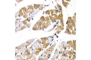 Immunohistochemistry of paraffin-embedded mouse heart using PPP1R12A Antibody (ABIN5974045) at dilution of 1/100 (40x lens). (PPP1R12A anticorps)