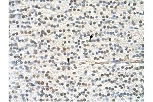 GAPVD1 antibody was used for immunohistochemistry at a concentration of 4-8 ug/ml to stain Neural cells (arrows) in Human Brain. (GAPVD1 anticorps  (N-Term))