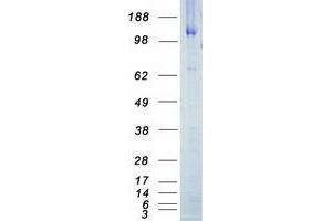 Validation with Western Blot