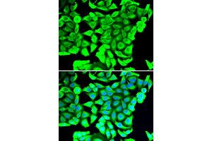Immunofluorescence analysis of MCF-7 cells using DCD antibody (ABIN5974382).