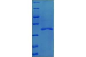 Transforming Growth Factor, beta 1 (TGFB1) (AA 2-259) protein (His tag) expressed in E.