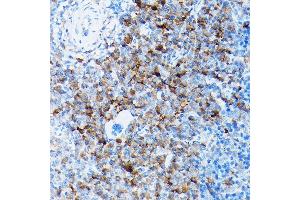 Immunohistochemistry of paraffin-embedded mouse spleen using SLC8 Rabbit pAb (ABIN6132664, ABIN6148050, ABIN6148052 and ABIN6221228) at dilution of 1:100 (40x lens).