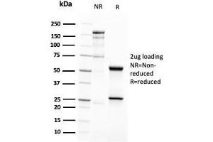 SDS-PAGE Analysis Purified CD63 Mouse Recombinant Monoclonal Antibody (LAMP3/2788).