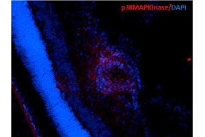 Immunohistochemistry analysis using Mouse Anti-p38 MAPK Monoclonal Antibody, Clone 9F12 .