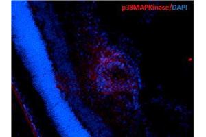 Immunohistochemistry analysis using Mouse Anti-p38 MAPK Monoclonal Antibody, Clone 9F12 . (MAPK14 anticorps  (Biotin))