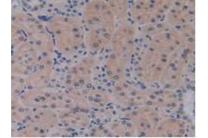 Detection of IL17RE in Rat Kidney Tissue using Polyclonal Antibody to Interleukin 17 Receptor E (IL17RE) (IL17RE anticorps  (AA 457-626))