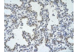 Rabbit Anti-ZRSR2 Antibody       Paraffin Embedded Tissue:  Human alveolar cell   Cellular Data:  Epithelial cells of renal tubule  Antibody Concentration:   4.