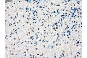 Immunohistochemical staining of paraffin-embedded endometrium tissue using anti-PORmouse monoclonal antibody. (POR anticorps)