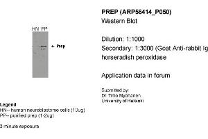 Western Blotting (WB) image for anti-Prolyl Endopeptidase (PREP) (Middle Region) antibody (ABIN2786689) (PREP anticorps  (Middle Region))