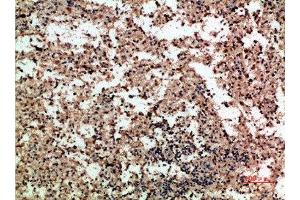 Immunohistochemical analysis of paraffin-embedded human-spleen, antibody was diluted at 1:200 (PF4 anticorps  (AA 51-100))