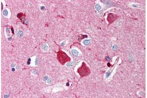Human Brain, Cortex (formalin-fixed, paraffin-embedded) stained with NGFR antibody ABIN214454 at 5 ug/ml followed by biotinylated goat anti-rabbit IgG secondary antibody ABIN481713, alkaline phosphatase-streptavidin and chromogen. (NGFR anticorps)