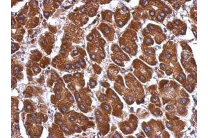 IHC-P Image Immunohistochemical analysis of paraffin-embedded human hepatoma, using ANGPTL3, antibody at 1:500 dilution. (ANGPTL3 anticorps)