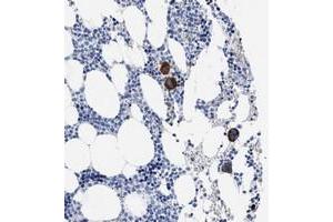 Immunohistochemical staining of human bone marrow with TREML1 polyclonal antibody  shows strong cytoplasmic positivity in megakaryocytes of bone marrow poietic cells. (TREML1 anticorps)