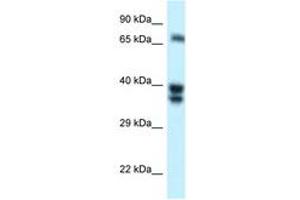 Image no. 1 for anti-SH3-Domain Binding Protein 1 (SH3BP1) (AA 125-174) antibody (ABIN6747750) (SH3BP1 anticorps  (AA 125-174))