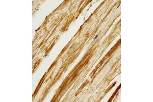 (ABIN6242156 and ABIN6578282) staining Zebrafish ak2 in zebra fish body tissue sections by Immunohistochemistry (IHC-P - paraformaldehyde-fixed, paraffin-embedded sections).