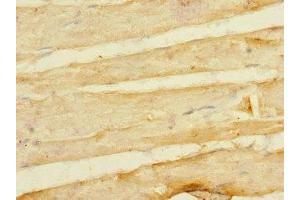 Immunohistochemistry of paraffin-embedded human skeletal muscle tissue using ABIN7158373 at dilution of 1:100