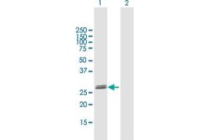 Western Blot analysis of GLIPR1L2 expression in transfected 293T cell line by GLIPR1L2 MaxPab polyclonal antibody. (GLIPR1L2 anticorps  (AA 1-253))