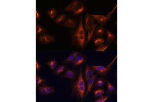 Immunofluorescence analysis of U-2 OS cells using Osteocalcin antibody (ABIN6134565, ABIN6137546, ABIN6137547 and ABIN6221793) at dilution of 1:100.