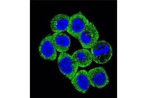 Confocal immunofluorescent analysis of PTEN antibody with HeLa cells followed by Alexa Fluor 488-conjugated goat anti-rabbit lgG (green).