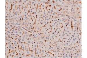 ABIN6267487 at 1/200 staining Mouse liver tissue sections by IHC-P.
