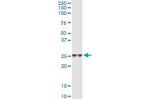 Immunoprecipitation of C4orf43 transfected lysate using anti-C4orf43 MaxPab rabbit polyclonal antibody and Protein A Magnetic Bead , and immunoblotted with C4orf43 purified MaxPab mouse polyclonal antibody (B01P) . (C4orf43 anticorps  (AA 1-203))
