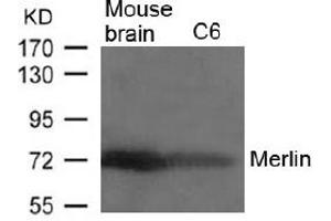 Image no. 2 for anti-Neurofibromin 2 (NF2) (AA 516-520) antibody (ABIN197520) (Merlin anticorps  (AA 516-520))