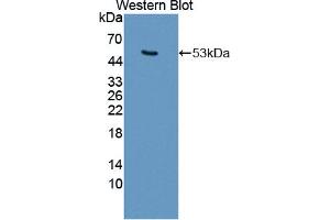 Western blot analysis of the recombinant protein. (Keratin 25 anticorps  (AA 1-446))