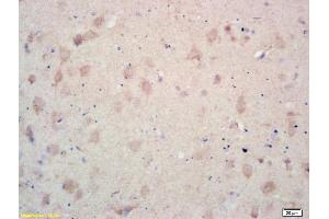 Formalin-fixed and paraffin embedded rat brain labeled with Rabbit Anti MCK10/CD167a/DDR1 Polyclonal Antibody, Unconjugated (ABIN671706) at 1:200 followed by conjugation to the secondary antibody and DAB staining (DDR1 anticorps  (AA 21-120))