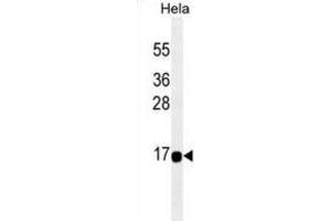 Western Blotting (WB) image for anti-Acyl-CoA Thioesterase 13 (ACOT13) antibody (ABIN2995329)