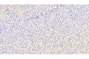 Detection of MFRN in Human Liver Tissue using Polyclonal Antibody to Mitoferrin (MFRN) (SLC25A37 anticorps  (AA 65-338))