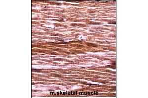 Mouse Akt2 Antibody (N-term) ((ABIN657827 and ABIN2846794))immunohistochemistry analysis in formalin fixed and paraffin embedded mouse skeletal muscle followed by peroxidase conjugation of the secondary antibody and DAB staining.