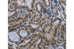 Immunohistochemistry (IHC) image for anti-Poly A Specific Ribonuclease (PARN) antibody (ABIN2423843)