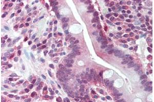 Human Small Intestine (formalin-fixed, paraffin-embedded) stained with BUB1 antibody ABIN293131 at 5 ug/ml followed by biotinylated goat anti-rabbit IgG secondary antibody ABIN481713, alkaline phosphatase-streptavidin and chromogen. (BUB1 anticorps  (N-Term))