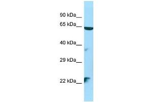 WB Suggested Anti-STK35 Antibody Titration: 1.