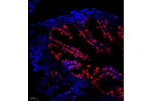Immunofluorescence of paraffin embedded mouse fallopian tubes using Thymosin (ABIN7075306) at dilution of 1:1500 (400x lens)