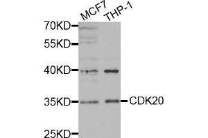Western blot analysis of extracts of various cell lines, using CDK20 antibody.