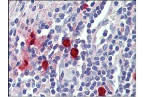 Tonsil, mast cells, Human: Formalin-Fixed, Paraffin-Embedded (FFPE) (CMA1 anticorps)