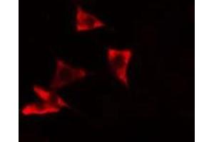 ABIN6278628 staining A549 cells by IF/ICC.