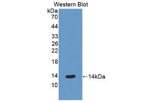 Detection of Recombinant ENA78, Human using Polyclonal Antibody to Epithelial Neutrophil Activating Peptide 78 (ENA78) (CXCL5 anticorps  (AA 41-132))