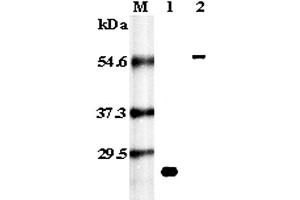 Western blot analysis using anti-RANK (human), pAb  at 1:5,000 dilution. (TNFRSF11A anticorps)