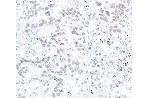 Immunohistochemistry (IHC) image for anti-Nucleoprotein TPR (TPR) (C-Term) antibody (ABIN7448922) (TPR anticorps  (C-Term))