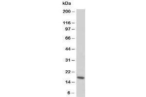 Western blot testing of Troponin C antibody and rat skeletal muscle tissue lysate (TNNC1 anticorps  (N-Term))