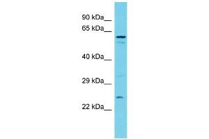 Host: Rabbit Target Name: TXNDC9 Sample Type: MDA-MB-435S Whole Cell lysates Antibody Dilution: 1. (TXNDC9 anticorps  (N-Term))