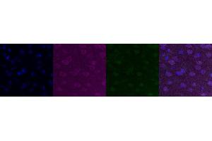 Immunohistochemistry (IHC) image for anti-Cholinergic Receptor, Nicotinic, alpha 6 (CHRNA6) antibody (ABIN7455986)